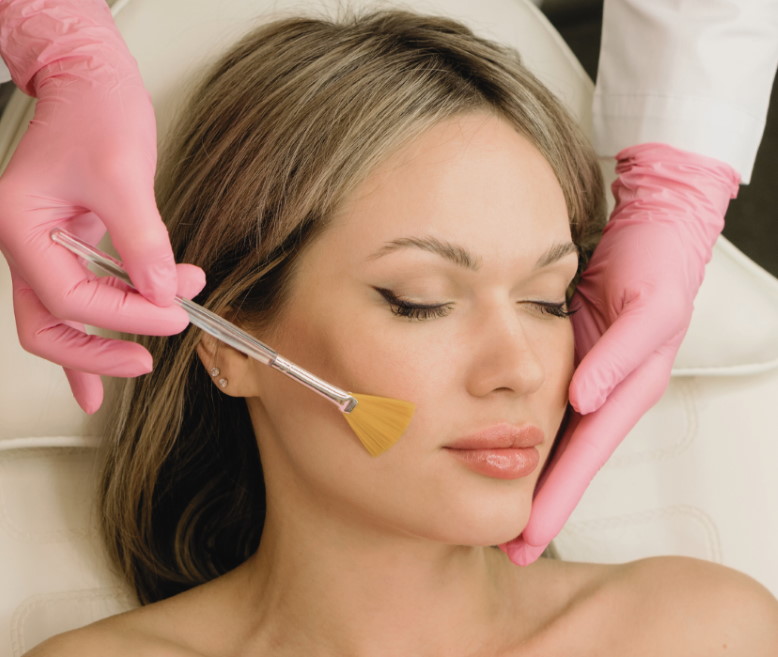 Tratamiento-peeling-quimico-piel