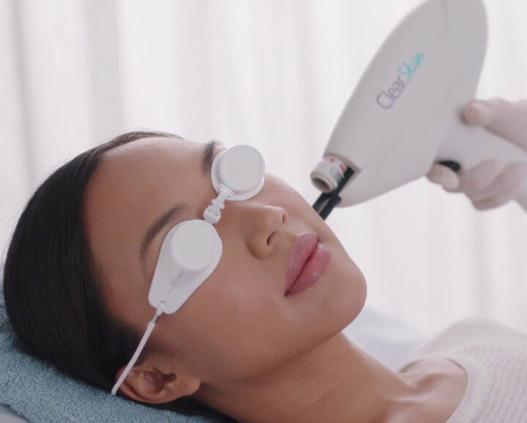 remodelacion-resurfacing-piel