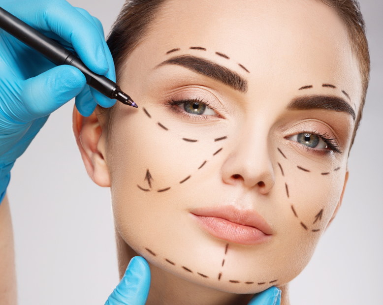 tratamiento-Bichectomia