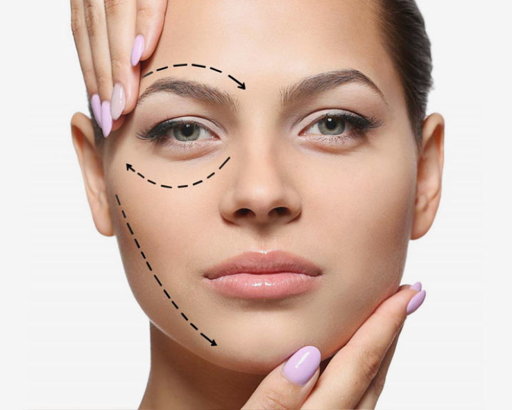 tratamiento-hilos-tensores