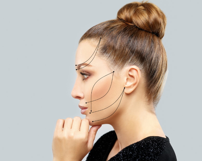 tratamiento-minilifting-facial